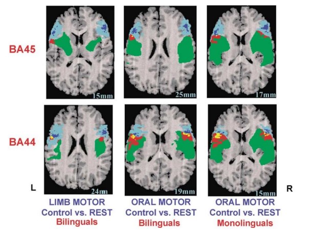 Figure 1 Brain activation during language production of bilinguals and monolinguals considering moves [1].
